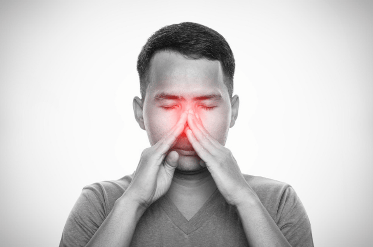 Sinusitis Treatment