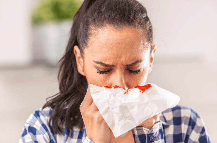 Nose bleeding (Epistaxis)